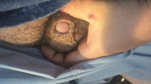 Little dick faggot